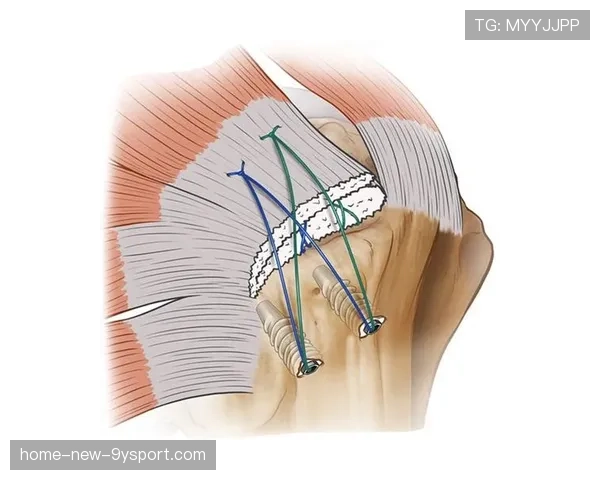 全球运动医学合作计划纳入多边机制推进平台，世界运动医学